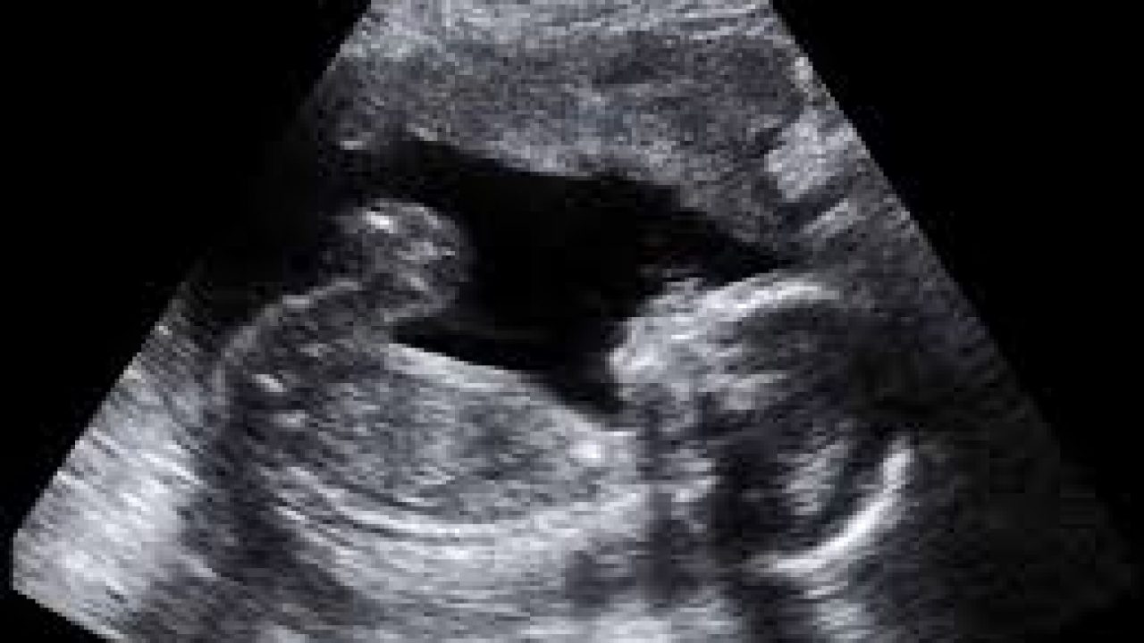 ultrasonda bebek bebekler